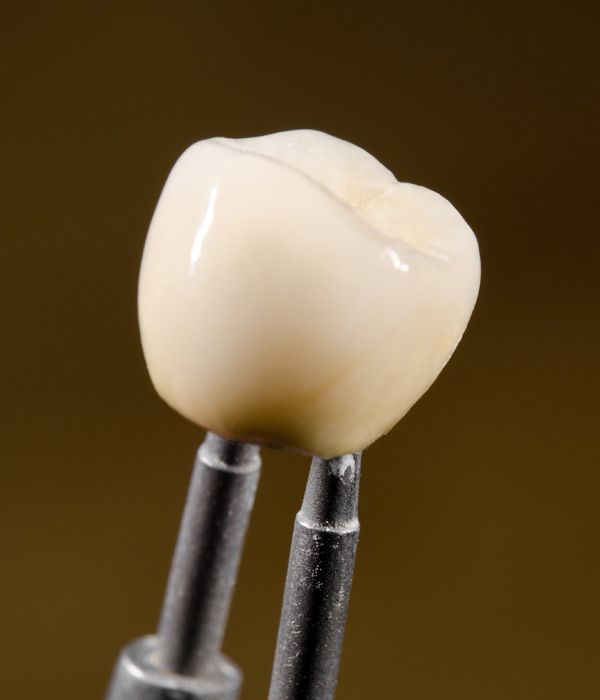 Photo of a dental crown