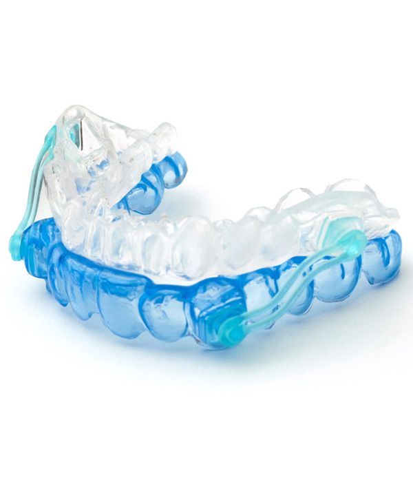 Photo of an oral appliance