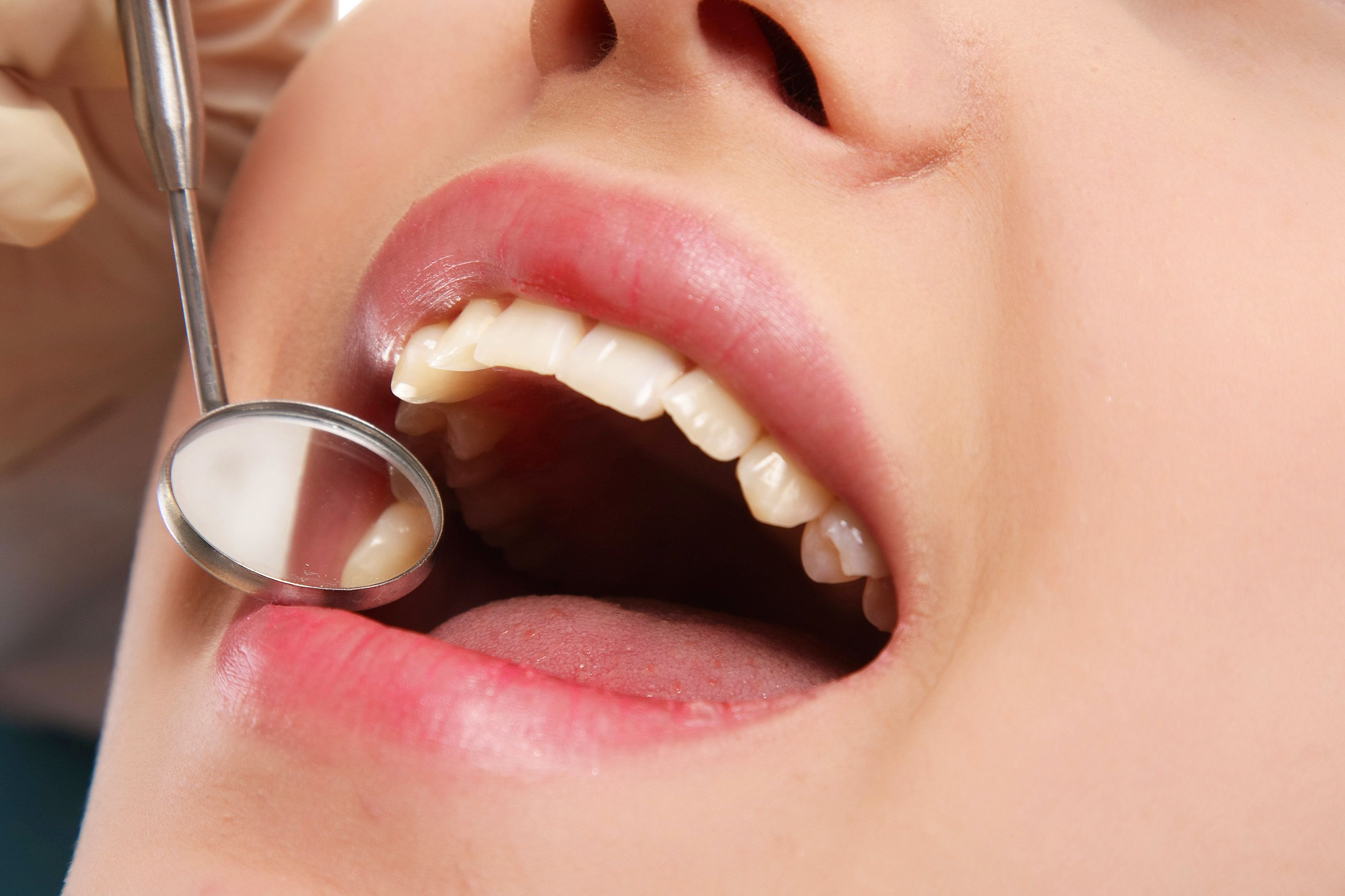 Close up of woman undergoing dental checkup